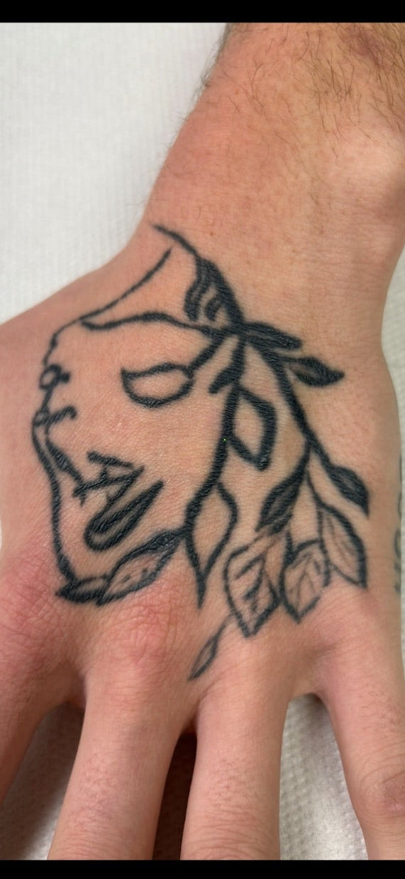 Hand, Neck & Face Laser Tattoo Removal