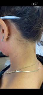 Neck Shaping Laser Hair Removal