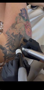 Laser Tattoo Fading for Cover-Ups