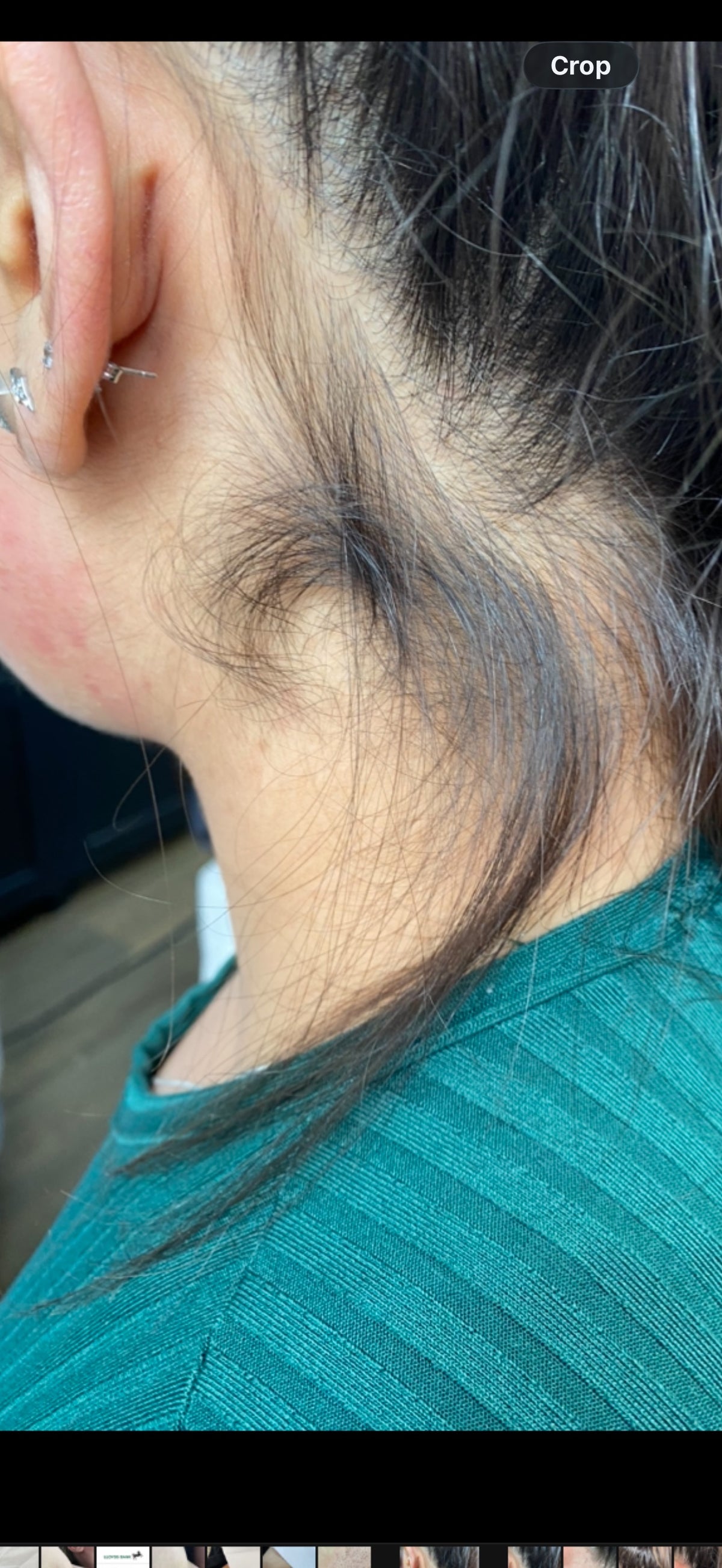 Neck Shaping Laser Hair Removal