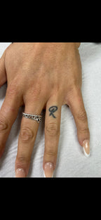 Hand, Neck & Face Laser Tattoo Removal
