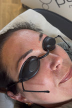 Eyebrow Tattoo Laser Removal