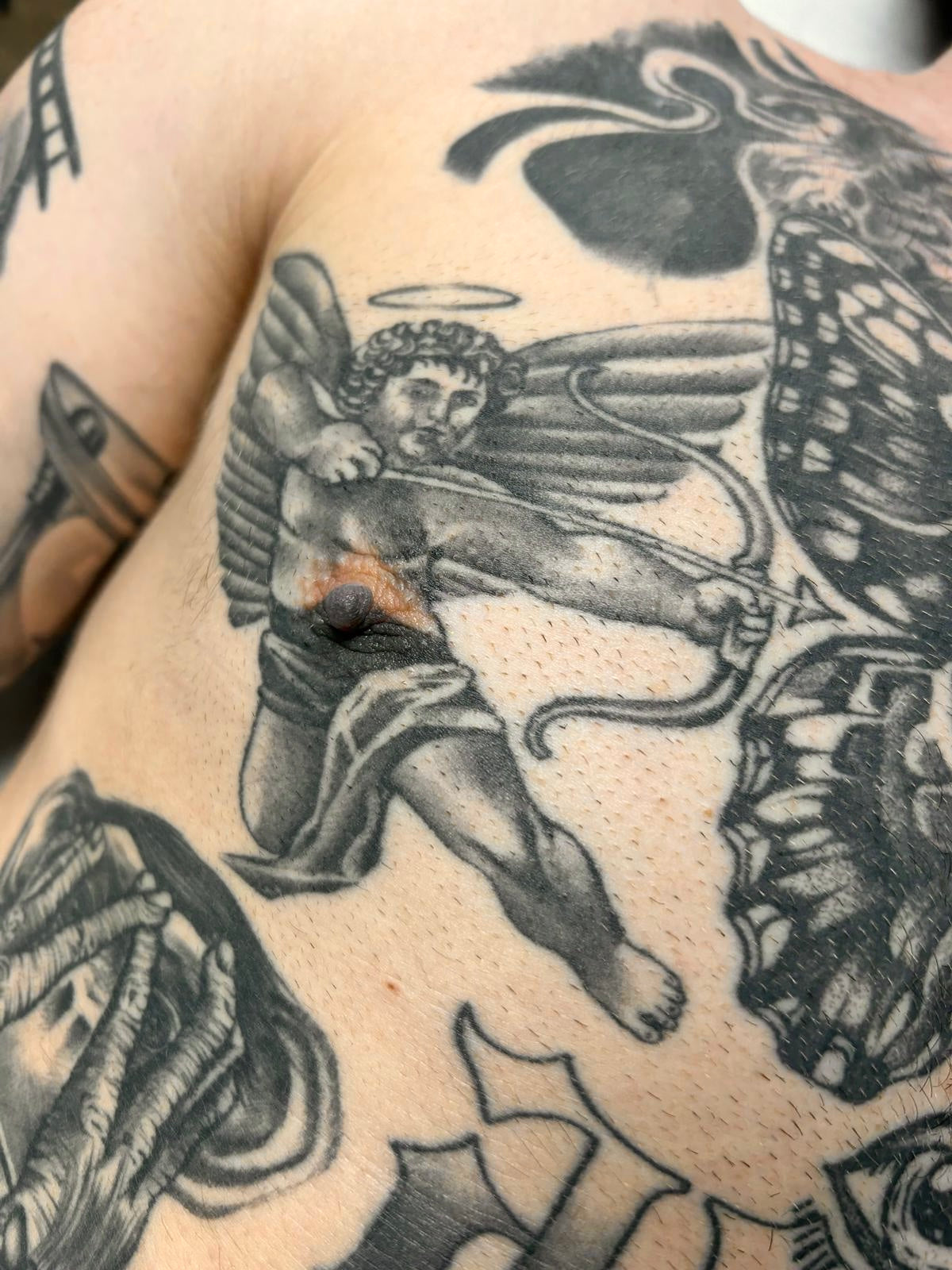 Laser Tattoo Fading for Cover-Ups