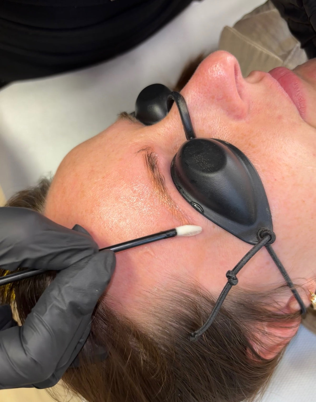 Eyebrow Tattoo Laser Removal