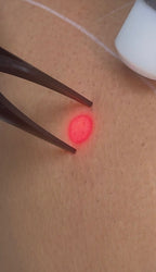 Full Stomach Laser Hair Removal