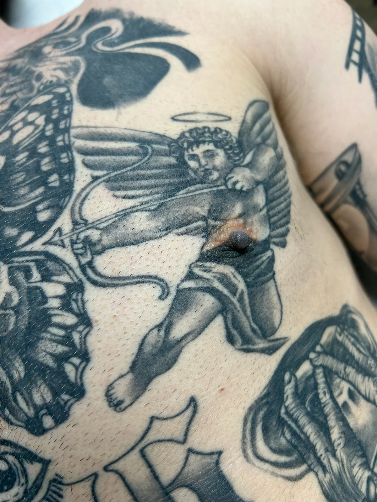 Body Laser Tattoo Removal