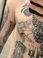 Laser Tattoo Fading for Cover-Ups