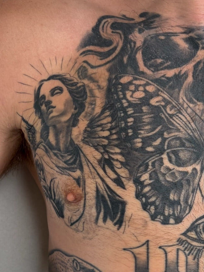 Laser Tattoo Fading for Cover-Ups