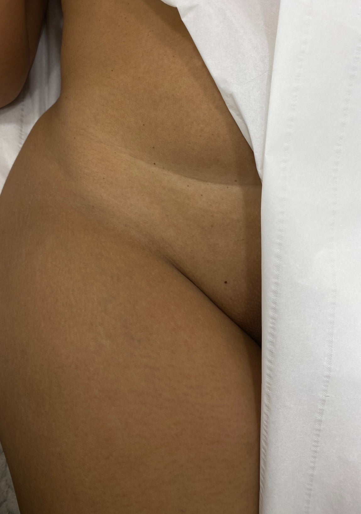 Full Body Laser Hair Removal