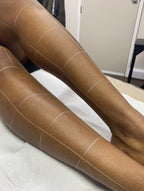 Full Leg Laser Hair Removal