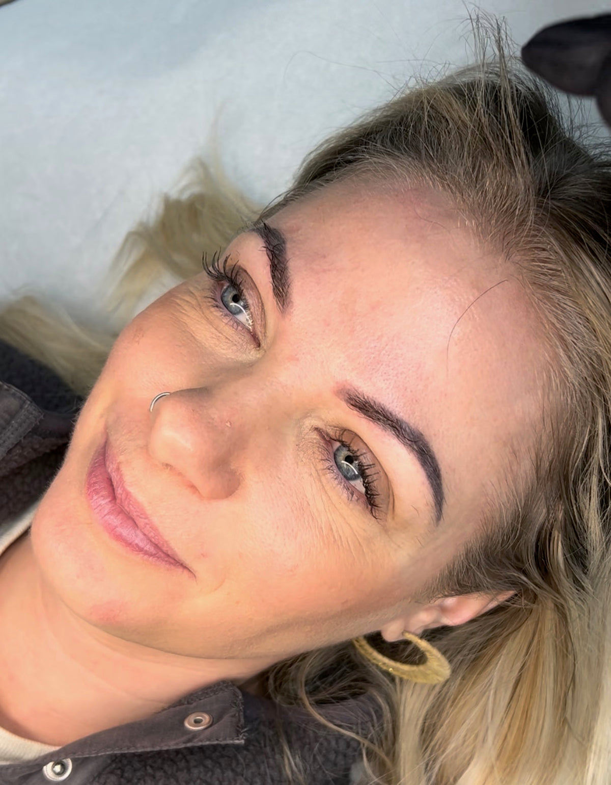 Eyebrow Tattoo Laser Removal