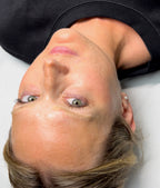 Eyebrow Tattoo Laser Removal