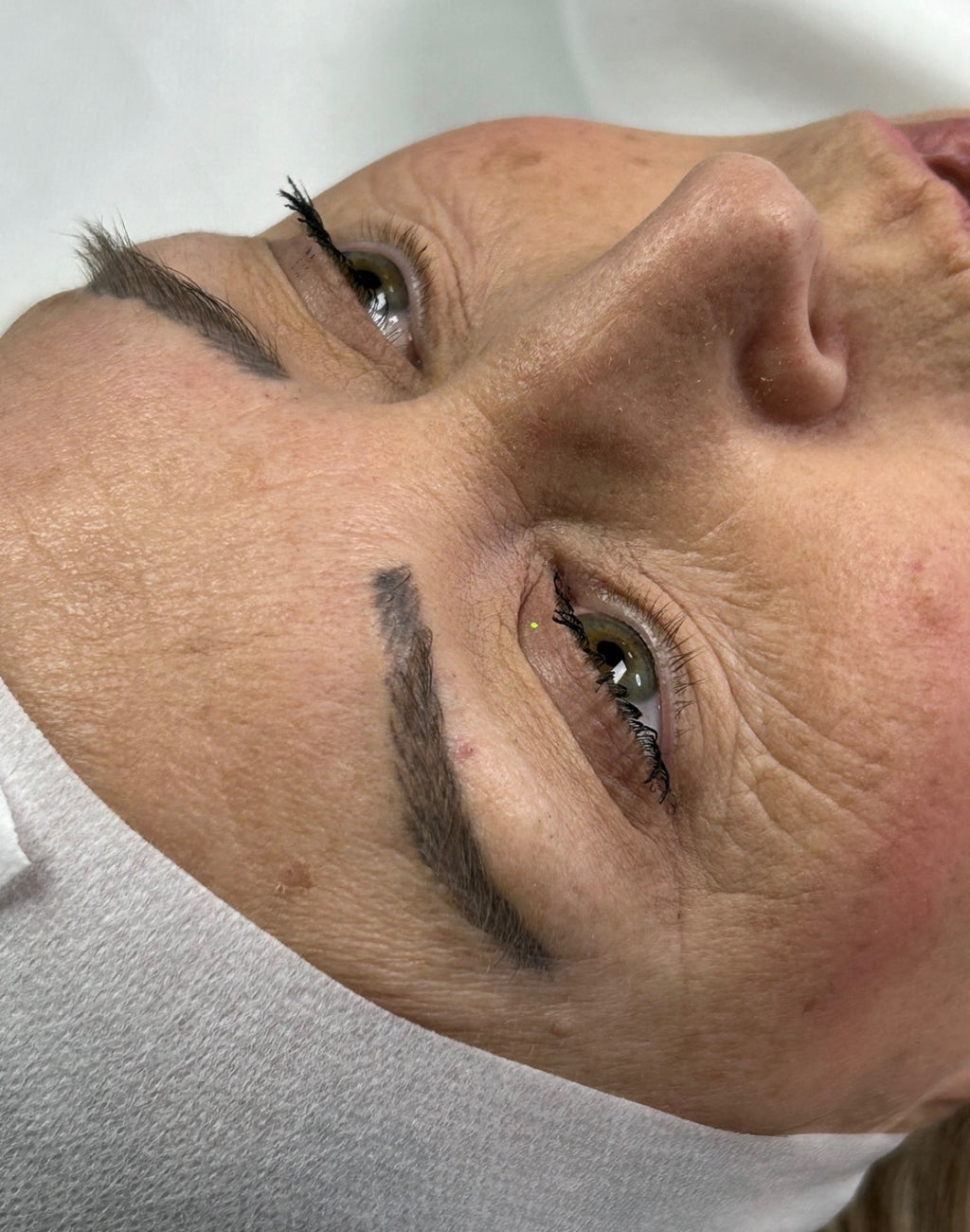 Eyebrow Tattoo Laser Removal