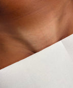 Hollywood Including Perianal Laser Removal