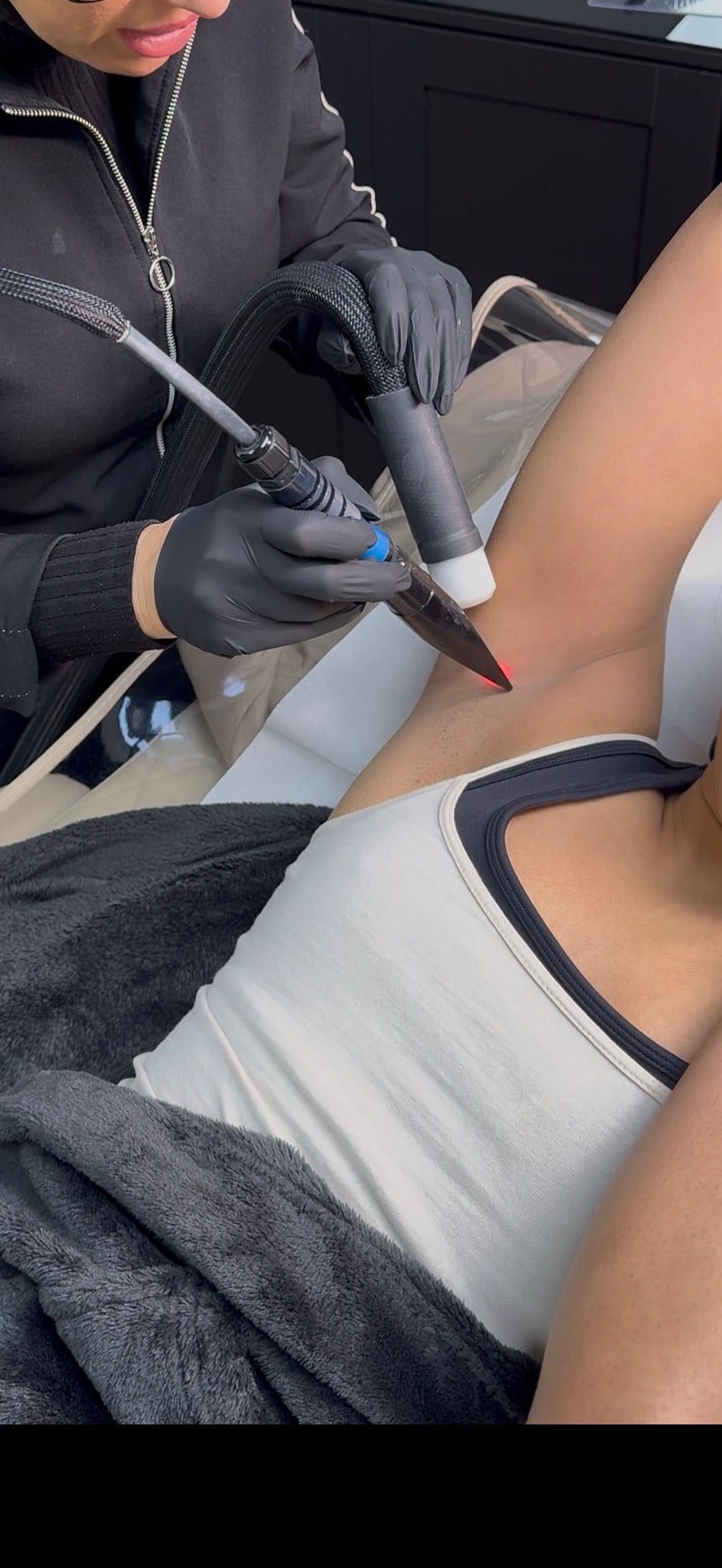 Underarm Laser Hair Removal