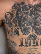 Body Laser Tattoo Removal