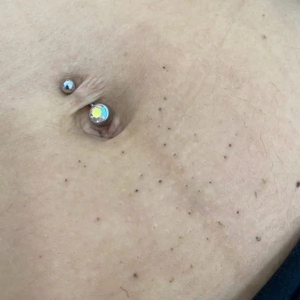 Navel Laser Hair Removal