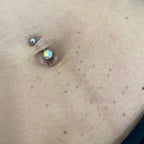 Navel Laser Hair Removal