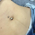 Navel Laser Hair Removal