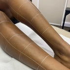 Lower Leg Laser Hair Removal